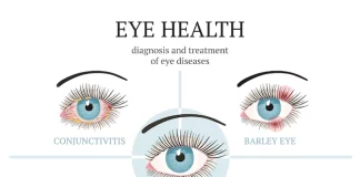 5 Common Eye Diseases in America and How to Prevent Them Close-up illustration comparing conjunctivitis, glaucoma, and dry eye syndrome symptoms